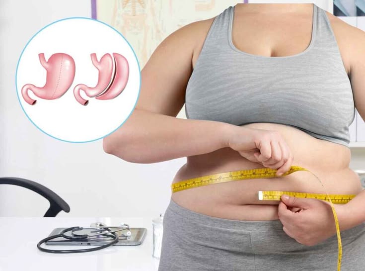Manga Gástrica por Laparoscopia en Innova Cirugías Ambato